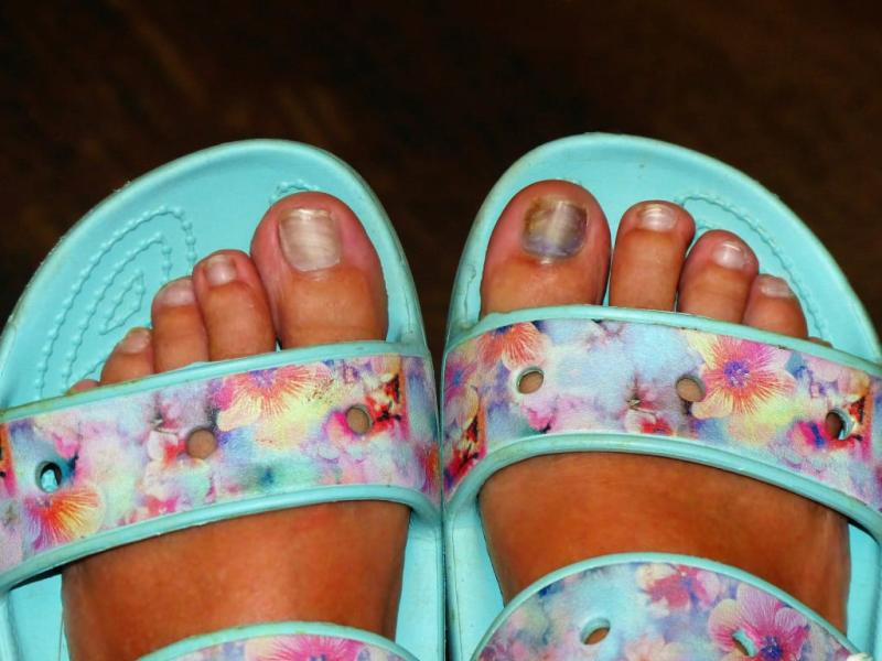 I stubbed my toe badly and can only wear my sandals so my toe doesn't jam up. And my sandals are SO comfy!