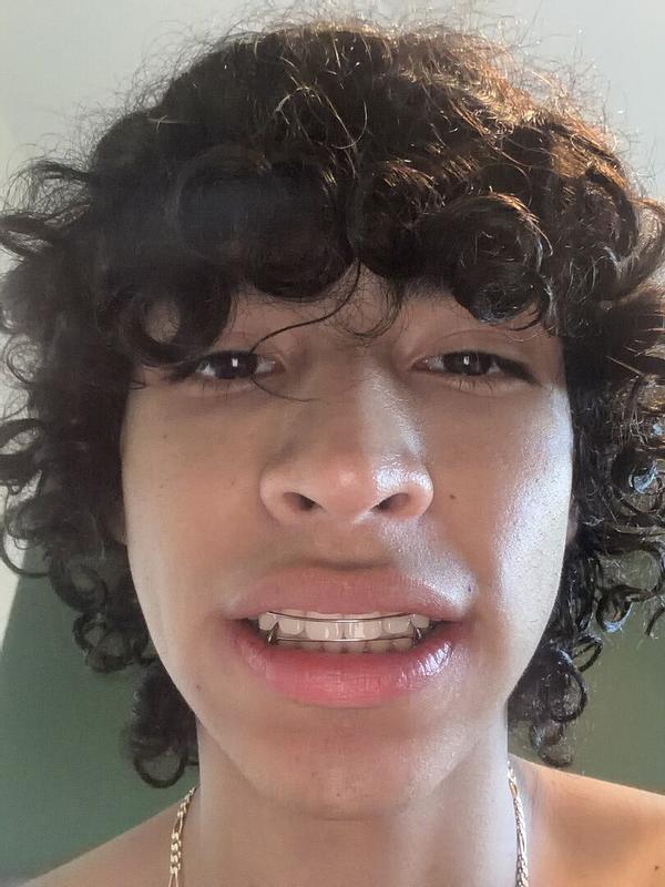 Review Thumbnail Image 0 376611419