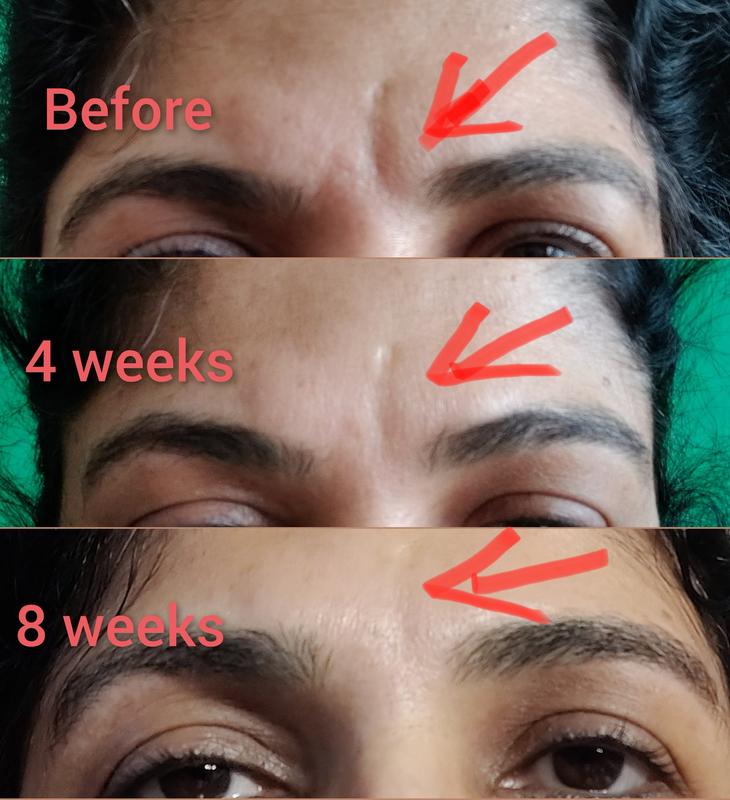 Artistry Skin Nutrition™ Firming Ultra Lifting Cream
