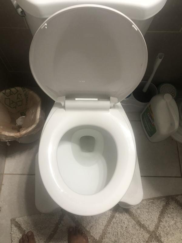 Principal 136+ imagen why is my toilet seat turning blue not pregnant