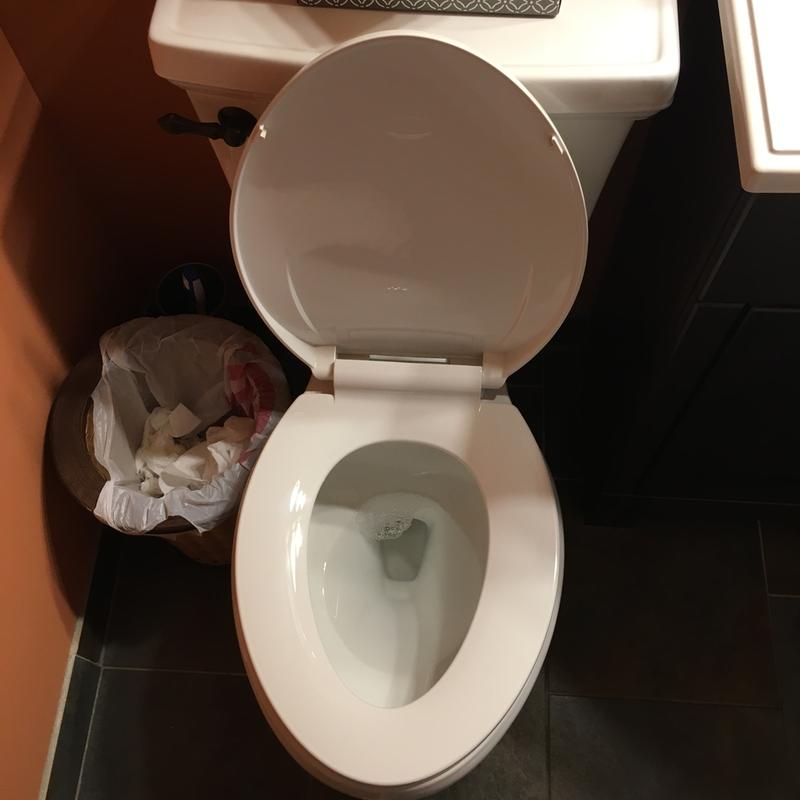 Principal 160+ imagen toilet seat turning blue not pregnant In