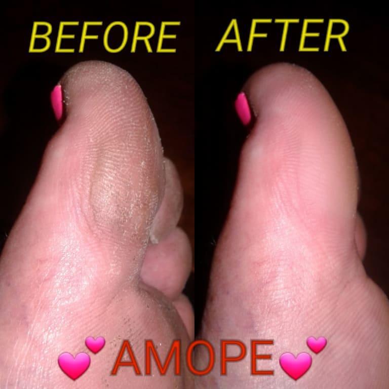 AMOPE® Pedi Perfect™- Electronic Foot File Ultra Coarse Diamond Crystal  Refills