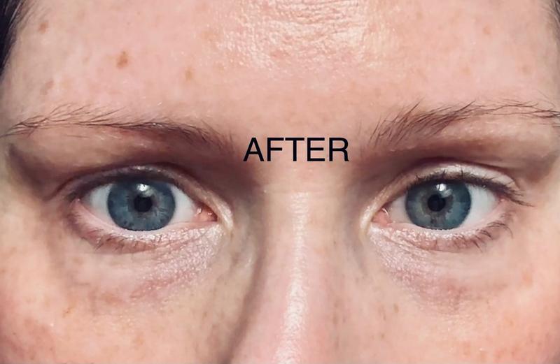 Customer photo for "New Technology = Results!"