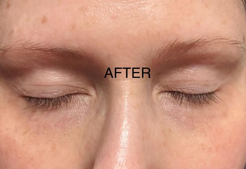 Customer photo for "New Technology = Results!"