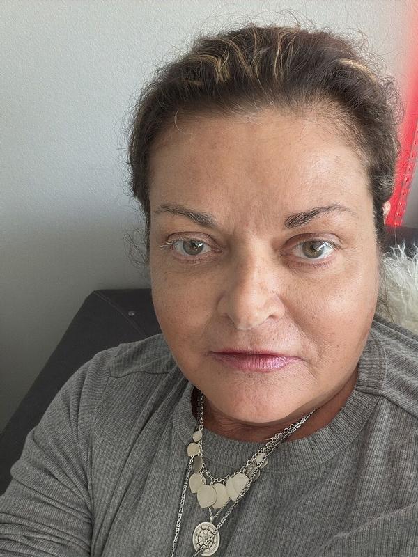 Customer photo for "It creates a youthful look"