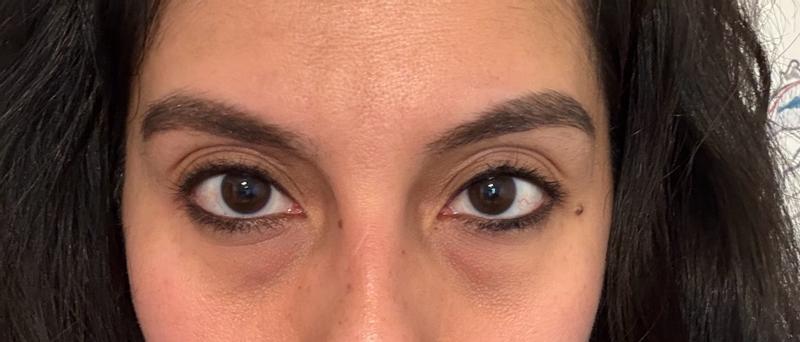 Customer carousel item 11.