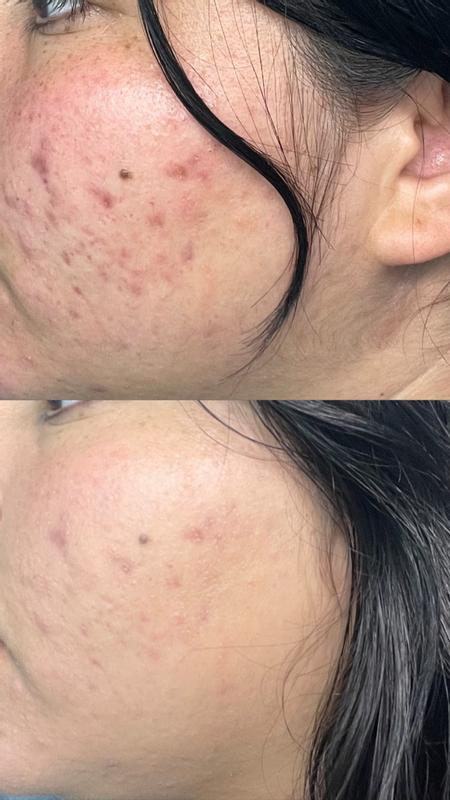 Customer carousel item 1.