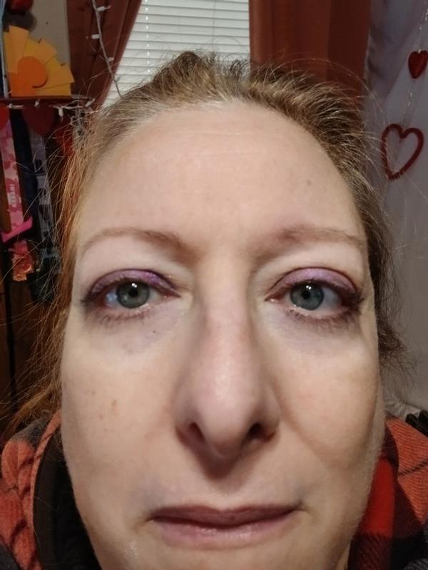 Review Thumbnail Image 1 299604434