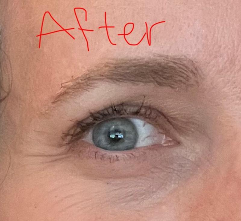 Before and after shots — amazing!