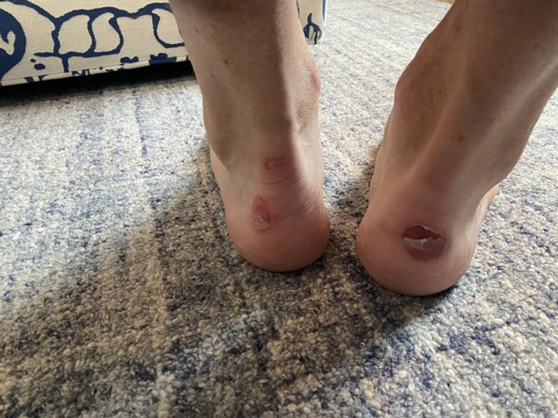 Photo submitted with review of product