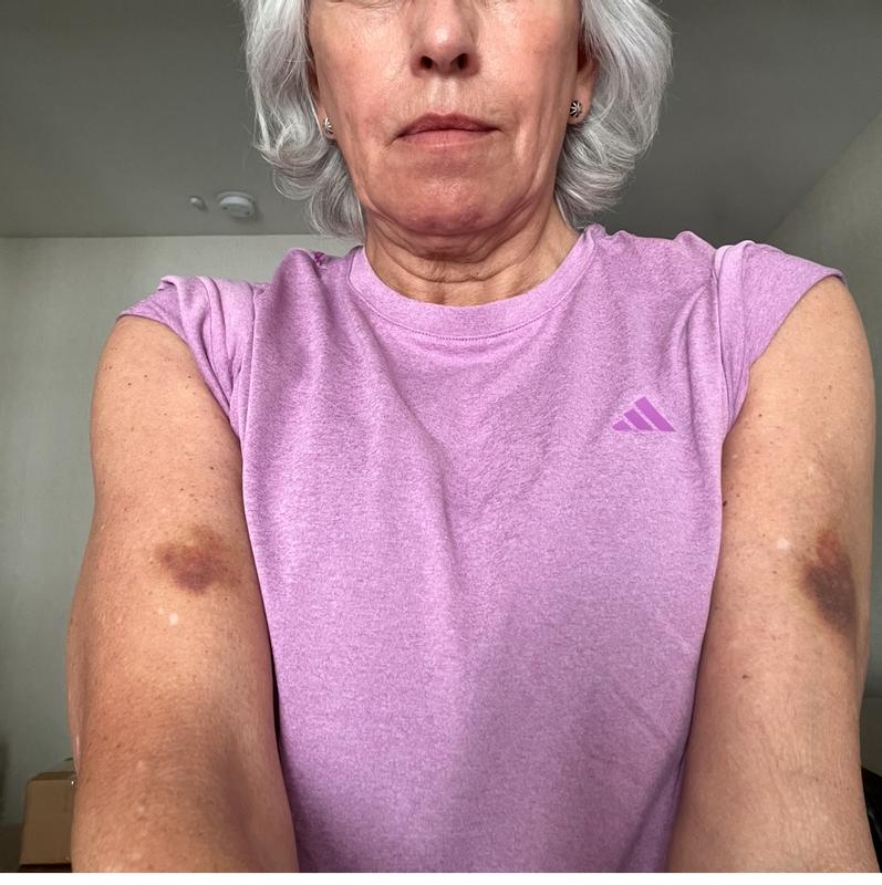Photo submitted with review of product