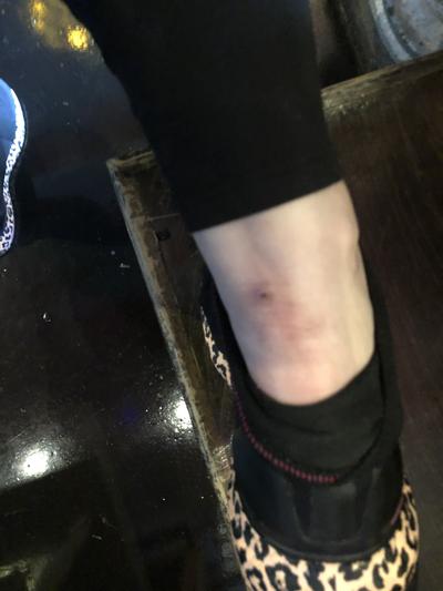 Photo submitted with review of product