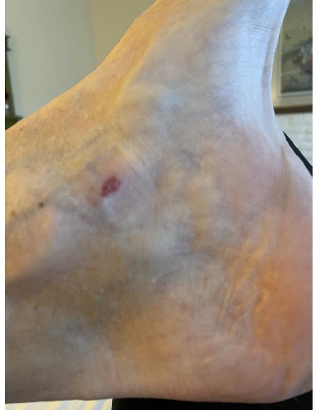 Photo submitted with review of product