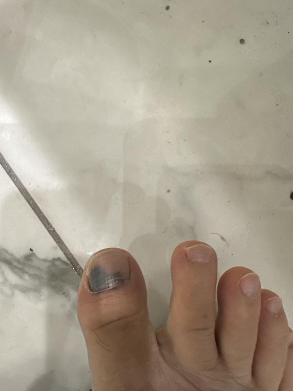 Photo submitted with review of product