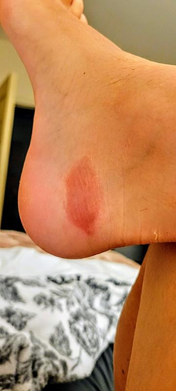 Photo submitted with review of product