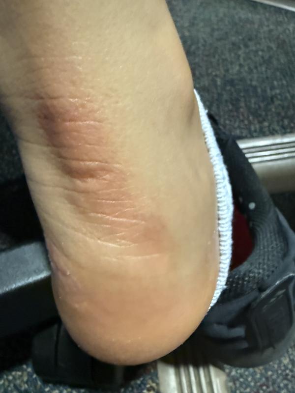 Photo submitted with review of product