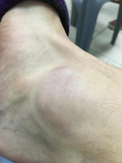 Photo submitted with review of product