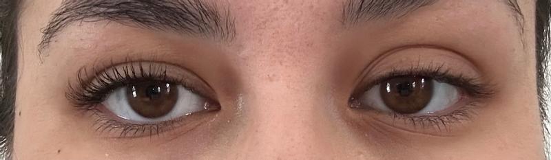 Customer carousel item 11.