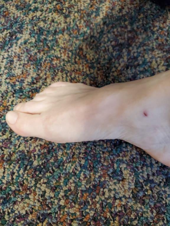 Photo submitted with review of product