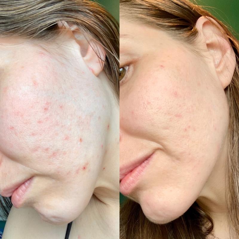 Photo submitted with review of product