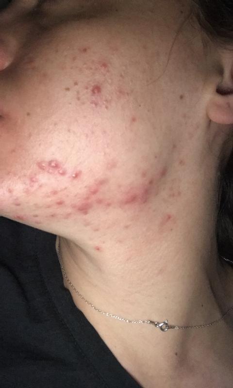 Photo submitted with review of product