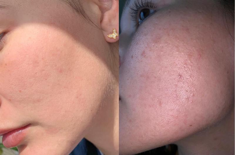 Photo submitted with review of product