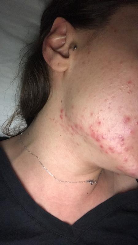 Photo submitted with review of product