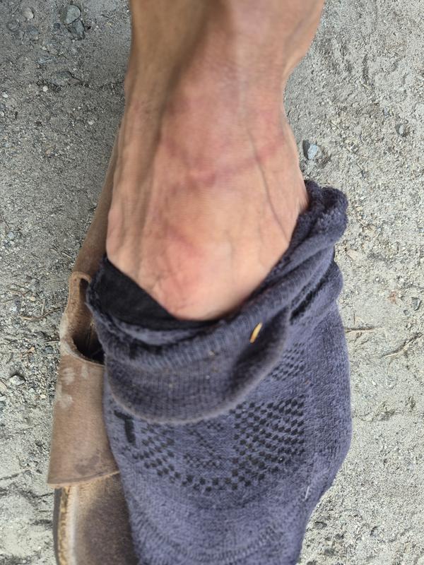 Customer photo for "Major issues with downhill performance"
