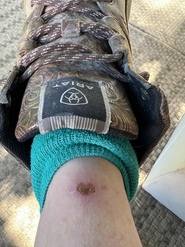 Sores from leather tongue!