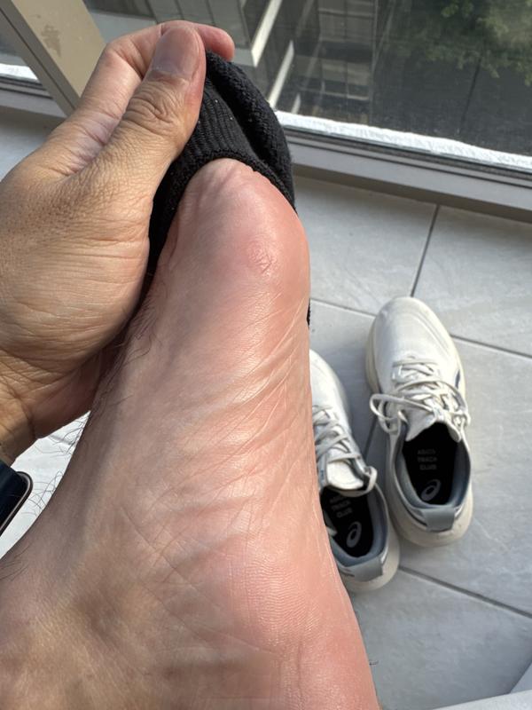 Photo from It hurts