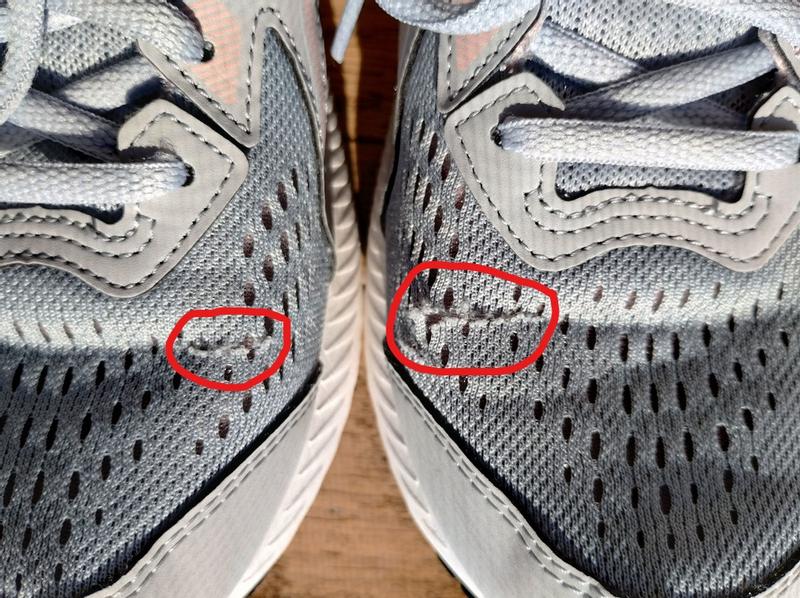 Tears in both creases