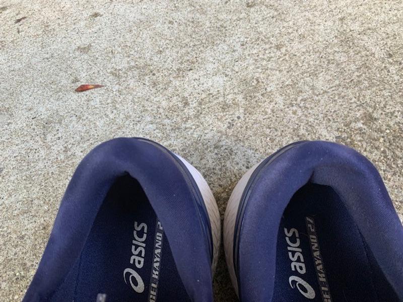 Side by side comparison, the right show is faulty