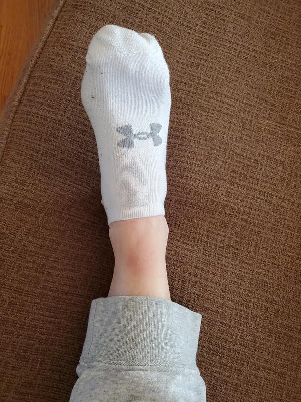 Bruise from the tongue of the shoe Cumulus 25