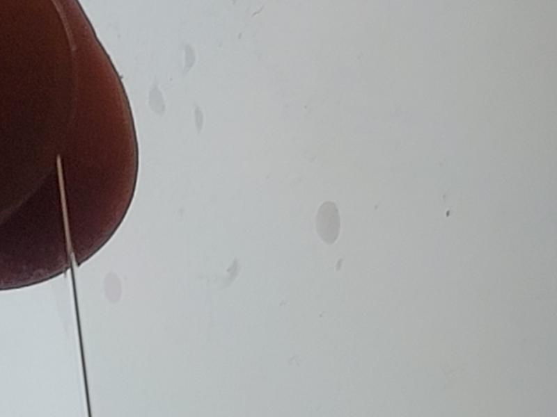 Imperfections in the actual screen that can't be removed. This is by itself not attached to the phone.