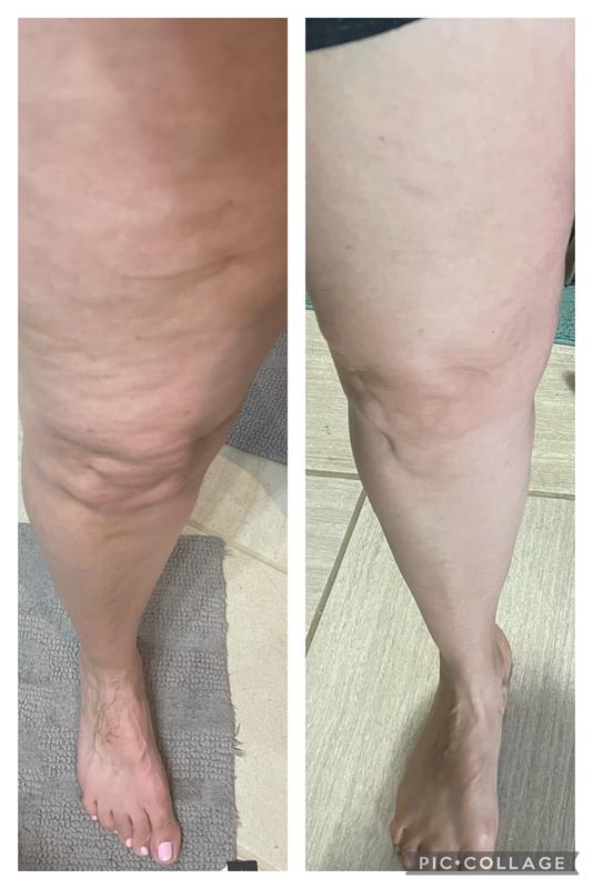 Customer photo for "Amazing"