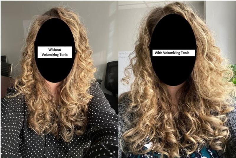 Customer photo for "Irritated Scalp, Dandruff & Frizz"