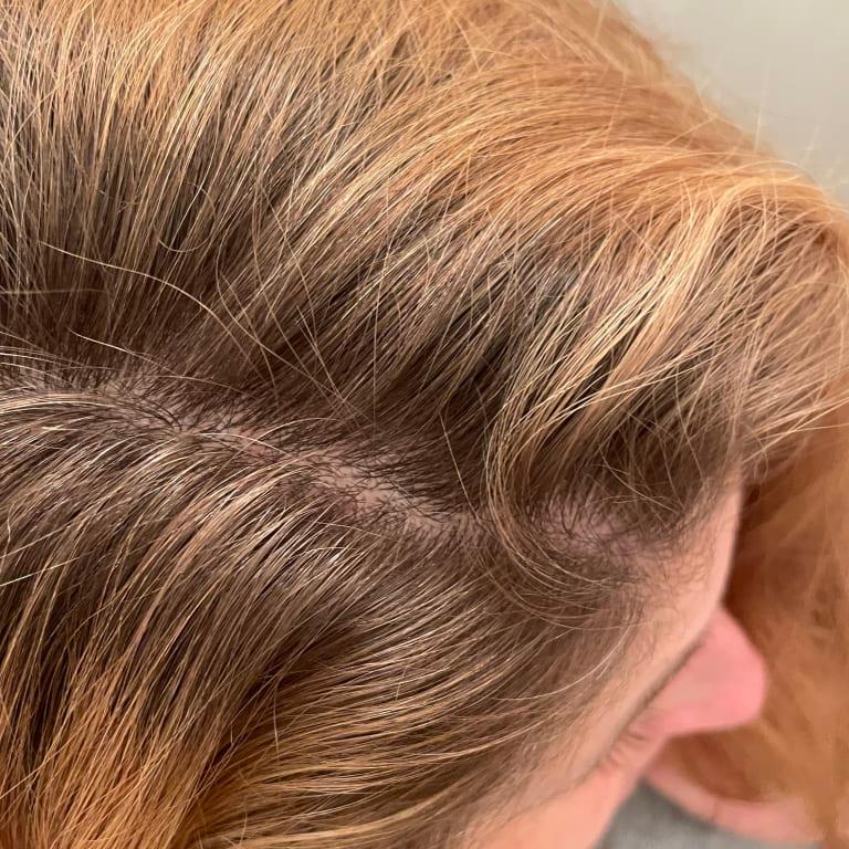 Customer photo for "Gel exfoliant for a cleaner scalp"