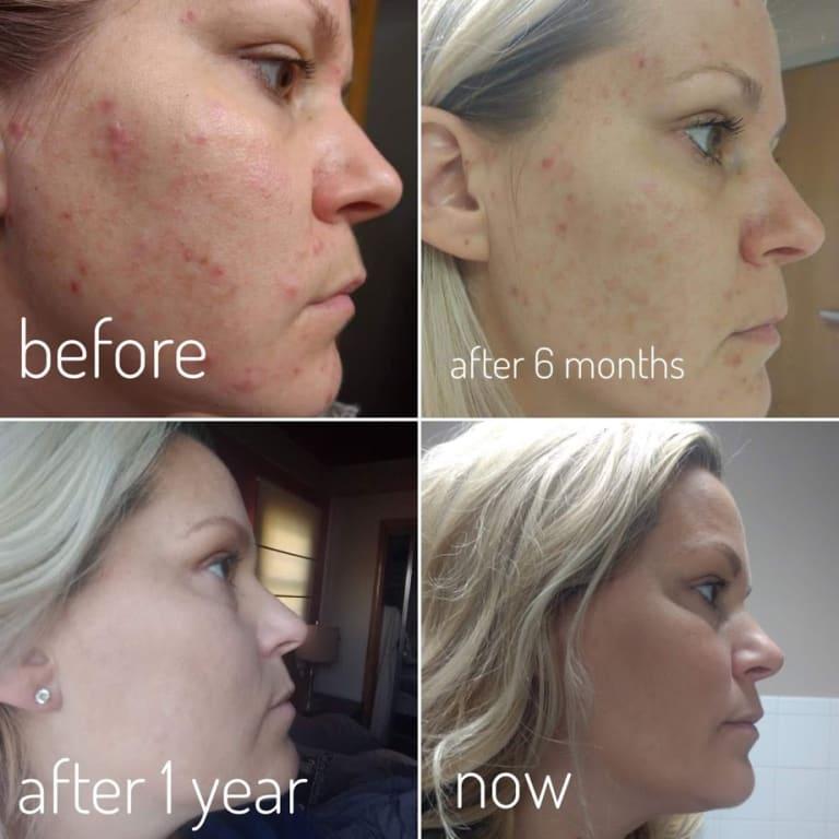 One year with Vitamin Enriched face base