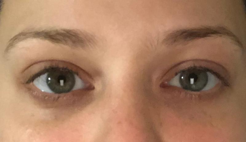 Customer photo for "Shocking results"