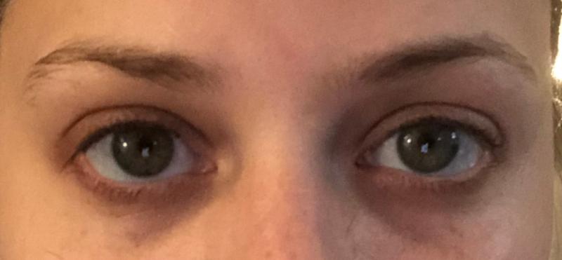 Customer photo for "Shocking results"