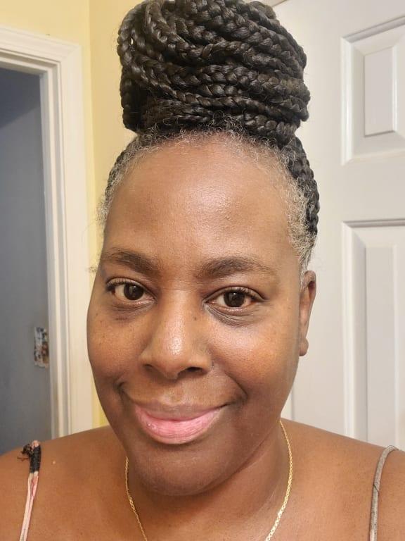 Customer photo for "Great serum"