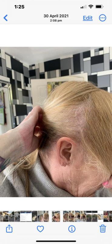 Customer photo for "Hi l have been using"