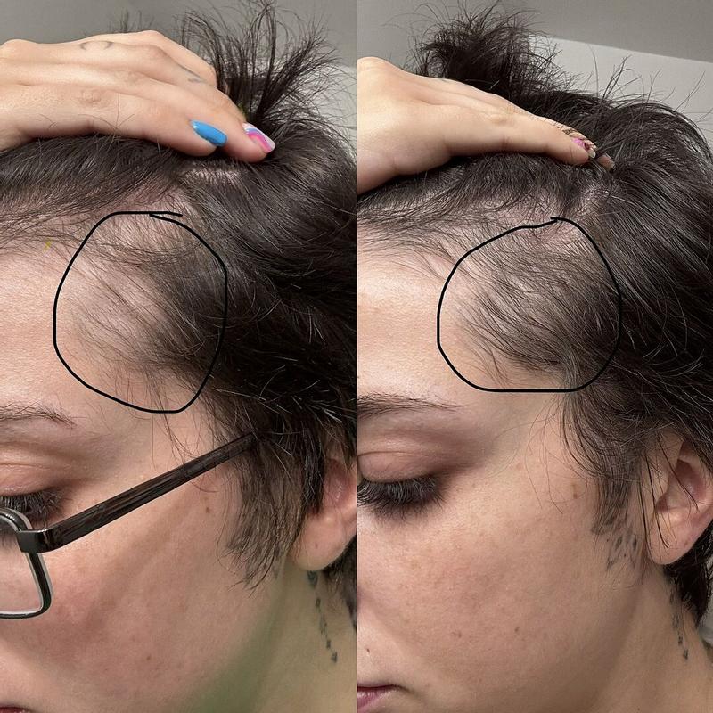 Customer photo for "Miracle product"