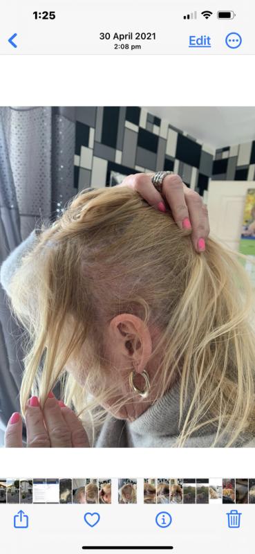 Customer photo for "Hi l have been using"