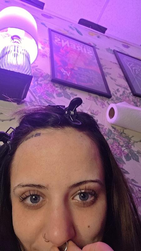 Customer photo for "best serum in the world"