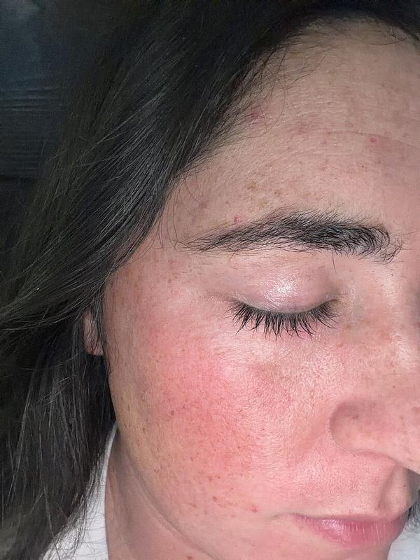 Review Thumbnail Image 0 377134208