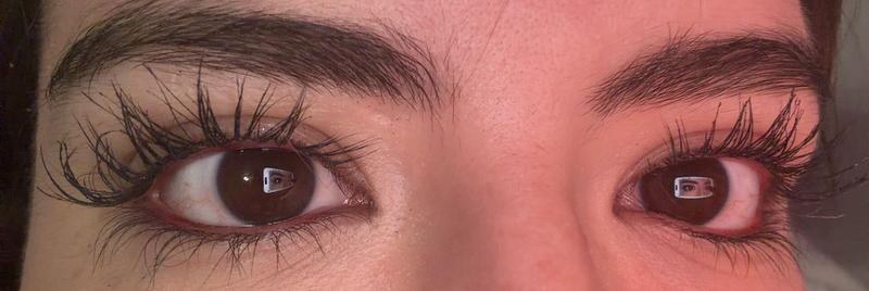 Customer photo for "Essential Lash Serum"