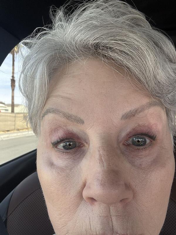 Review Thumbnail Image 0 384890796