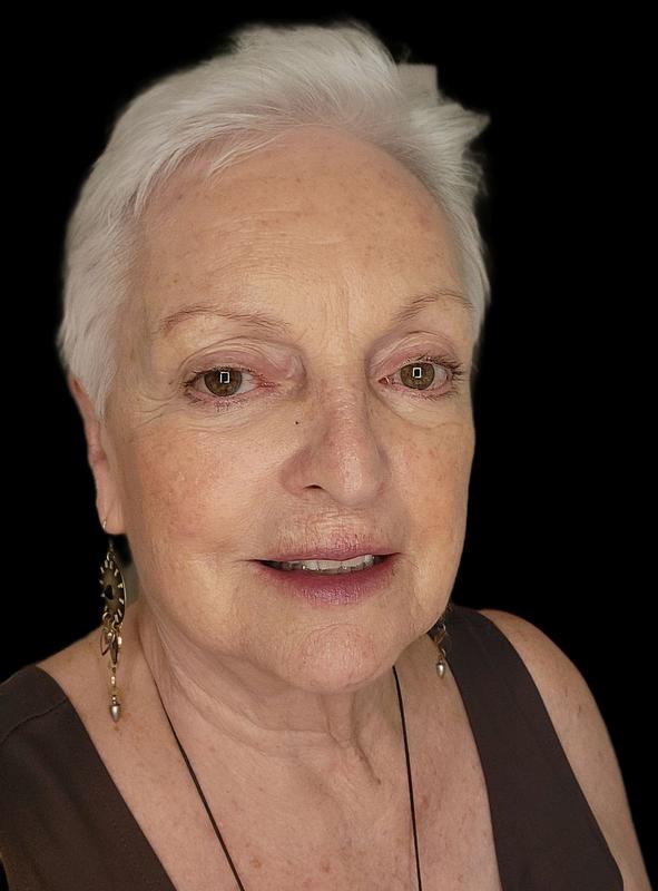 Customer photo for "Lovely product on 80 year old skin"