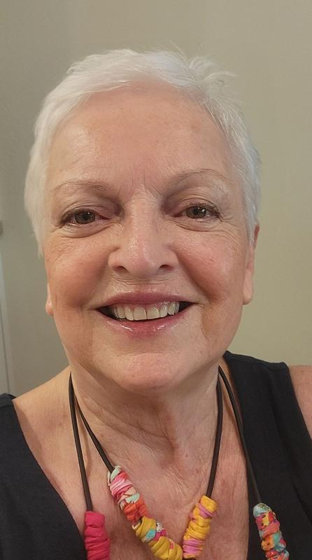Customer photo for "Minimized my 80 year old skin imperfections"